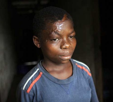 Sign Petition to End the Persecution of Africa’s So Called “Child Witches”