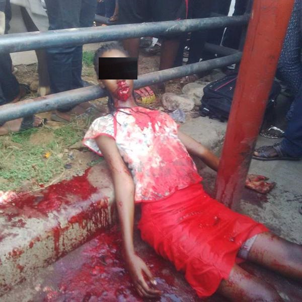 Exclusive: The Untold Story Of How Lagos Babe  Was Vomiting Blood  (viewer discretion is advised)