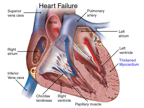 Are You Doing These 5 Frequent Problems On Your Heart?
