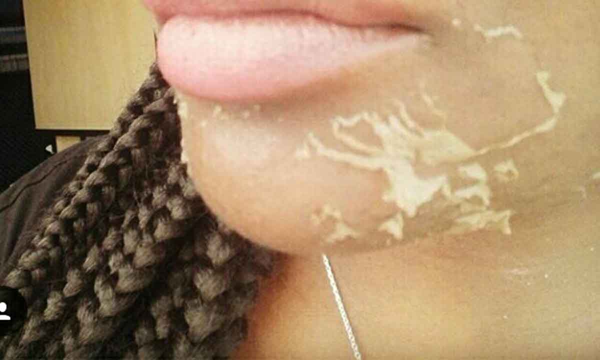 She is Bleaching her Skin and Fooling her viewers- Fan Blast Toolz