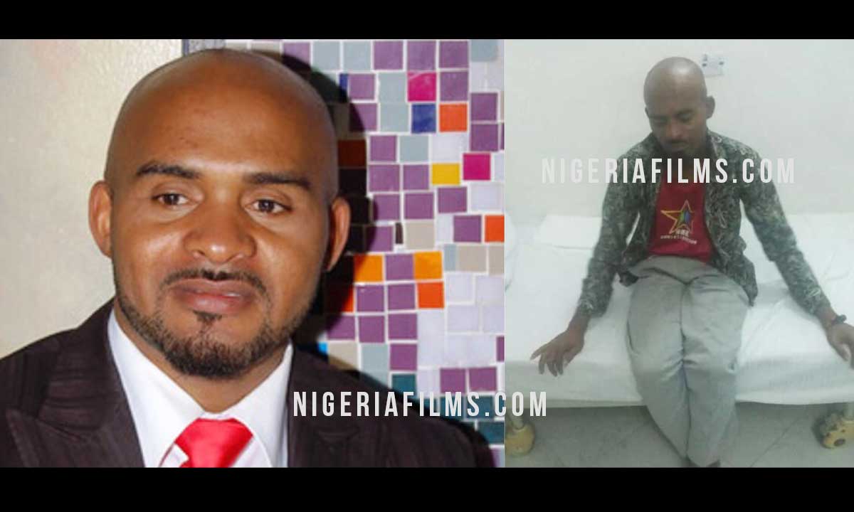 Shame: Nollywood Can’t Raise N10 Million to Save Dying Actor