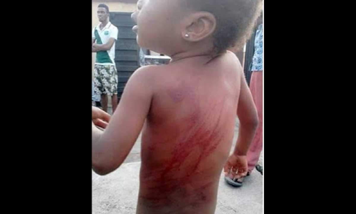 Pitiful: 4 Years Old Girl Brutally Tortured By Father Over lost Slippers!