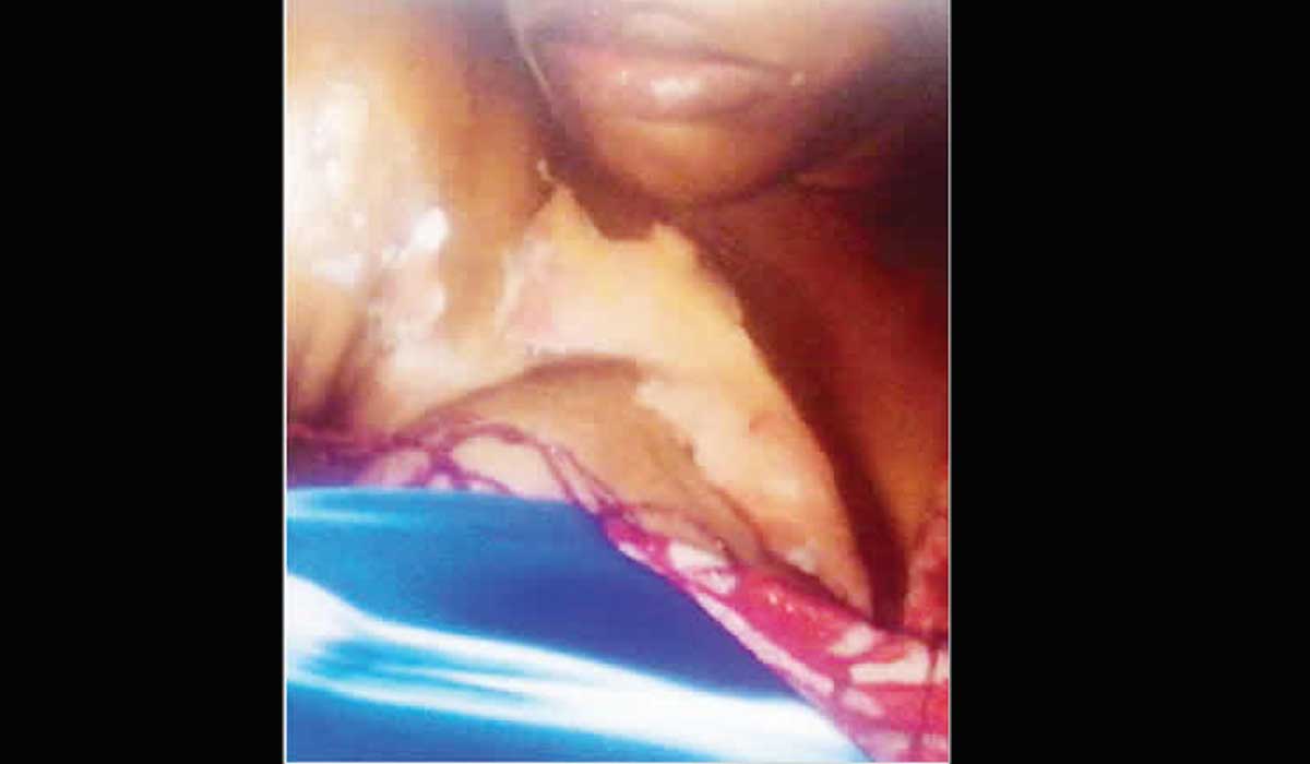 Stupidity: House Wives Empties Hot Water On Each Other Over Lover