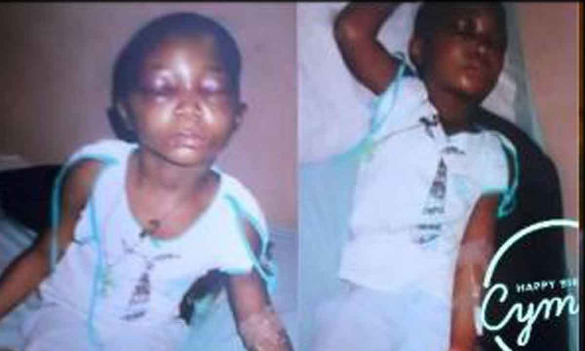 Guardian Inflicts Injury On 6 Years Old Portrayed As Witch!