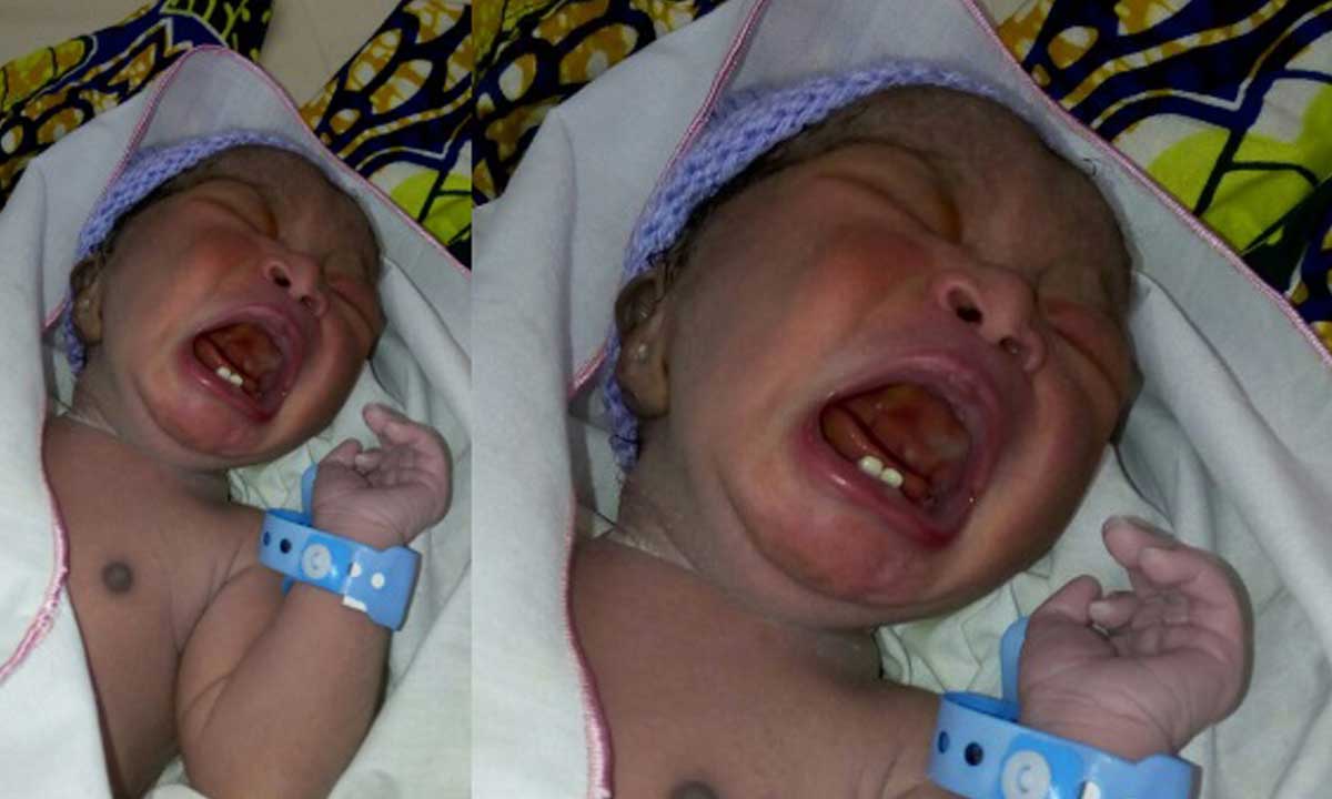 See Baby Born With Teeth
