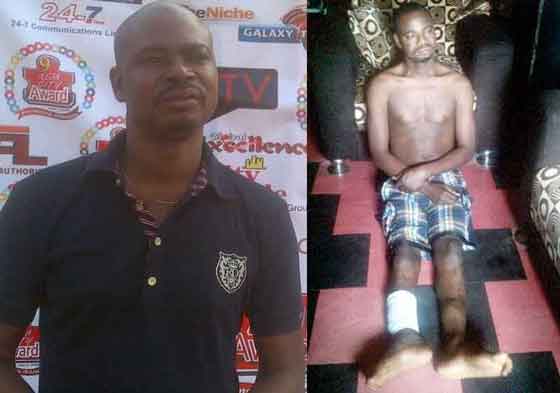 Another Nollywood Producer’s Leg To Be Amputated In India After Bone Infection
