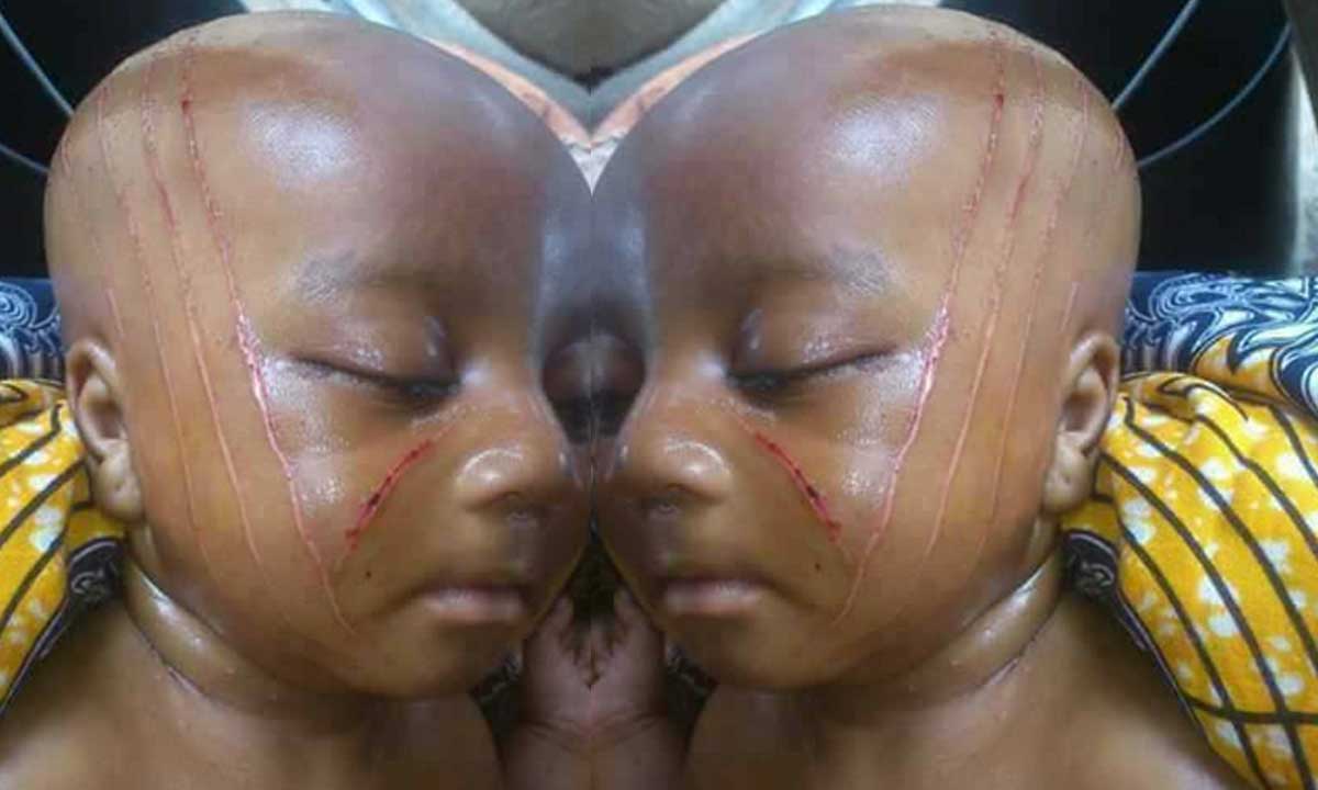 Dino Melaye Sets to Champion Bill to Stop Use of Tribal Marks on Children