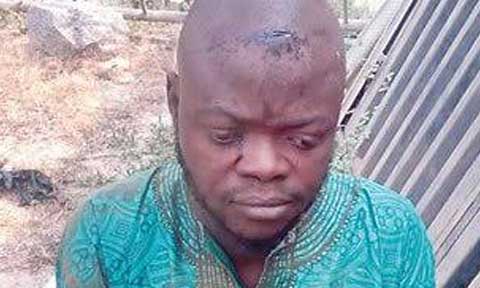 Man with Human Head Apprehended!