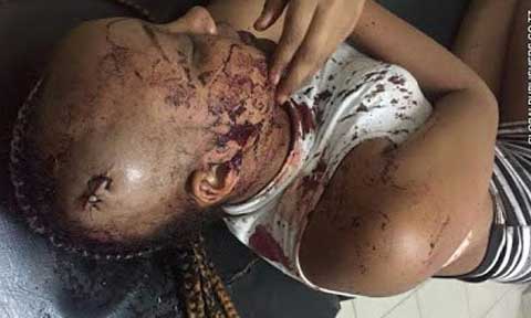 Photos: Beauty Queen Attacked And Left With A Broken Head By Robbers