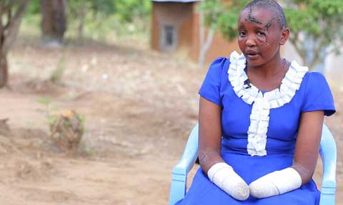 Woman Whose Hands Was chopped By Husband For Being Barren Conceives For Another Man
