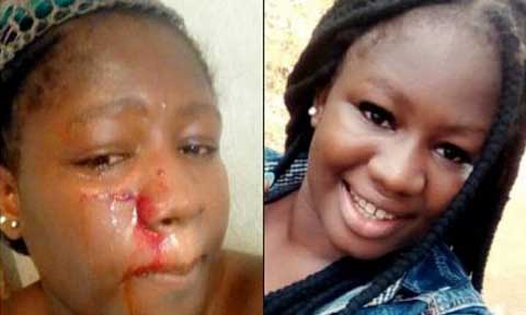 See Lady Who Got Serious Beating as Valentine Gift
