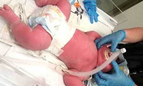 Woman Gives Birth to a Baby Who is 2 Times the Size of a Newborn (Photo)