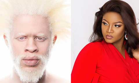 This Albino Guy Is Too Hot For Omotola Jalade To Keep Quiet