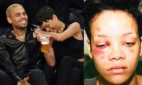 Chris Brown Admits He Punched Rihanna And Busted Her Lip