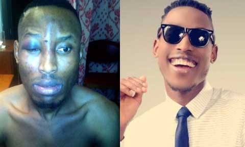 Report: Mr. 2kay Slams Eko Hotels With  N500m Lawsuit Over Attack