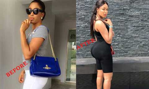 Is Non Of Your Business If I Undergo Butt Implant! – Dabota Lawson