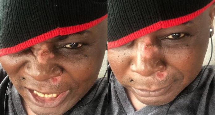 Serious Scooter Accident: Charly Boy Is Hale And Harty